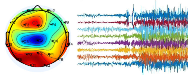 EEG recordings used for seizure prediction and Alzheimer’s detection
